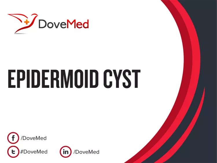 Are you satisfied with the quality of care to manage Epidermoid Cyst in your community?