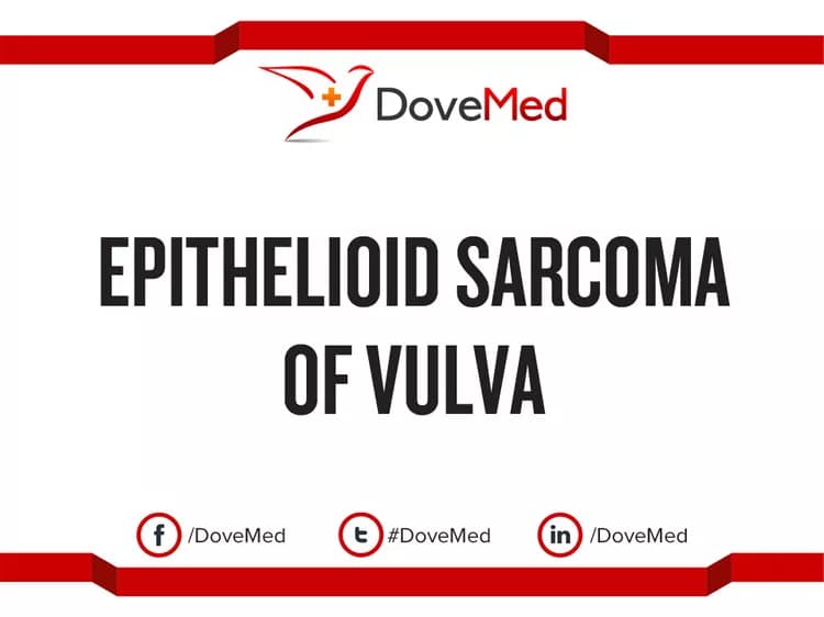 Are you satisfied with the quality of care to manage Epithelioid Sarcoma of Vulva in your community?