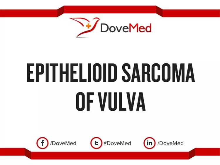 Epithelioid Sarcoma of Vulva