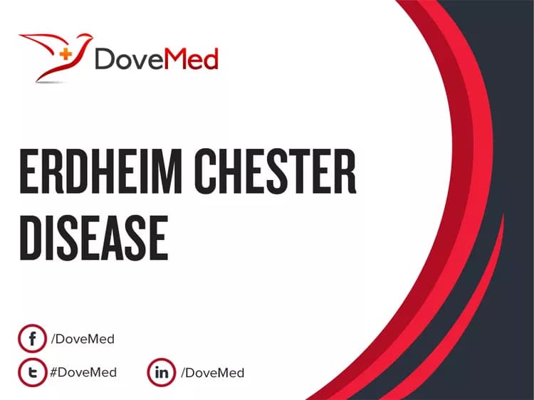 Erdheim Chester Disease (ECD)