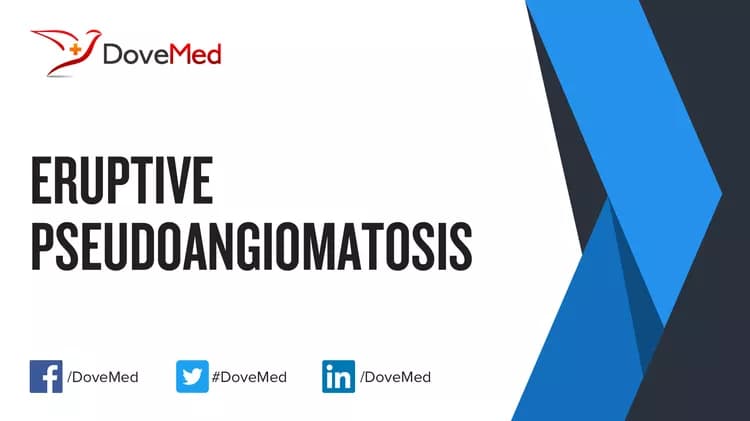 Can you access healthcare professionals in your community to manage Eruptive Pseudoangiomatosis?