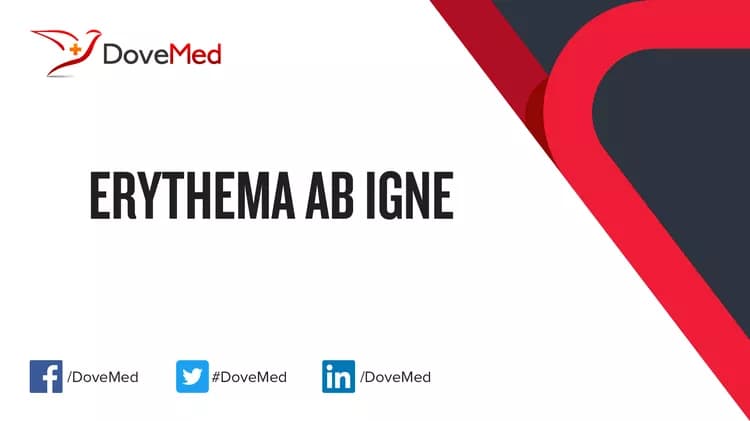 Can you access healthcare professionals in your community to manage Erythema Ab Igne?
