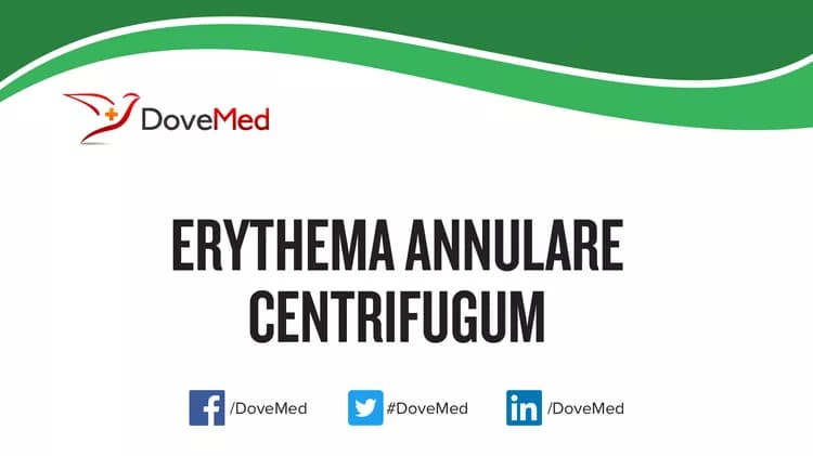 Erythema Annulare Centrifugum