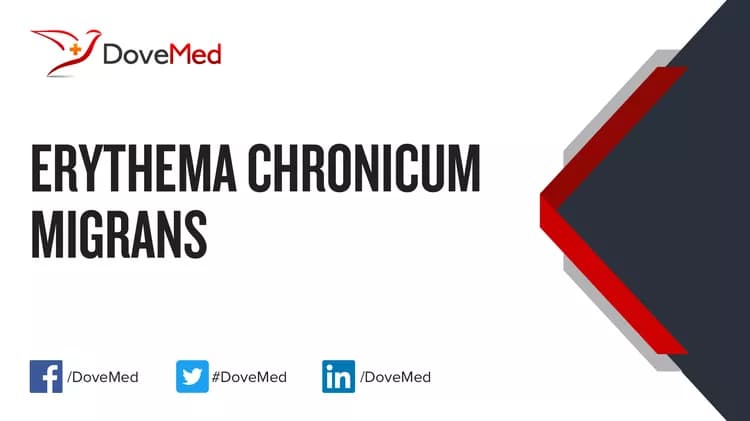 Can you access healthcare professionals in your community to manage Erythema Chronicum Migrans?