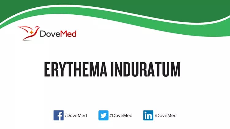Erythema Induratum