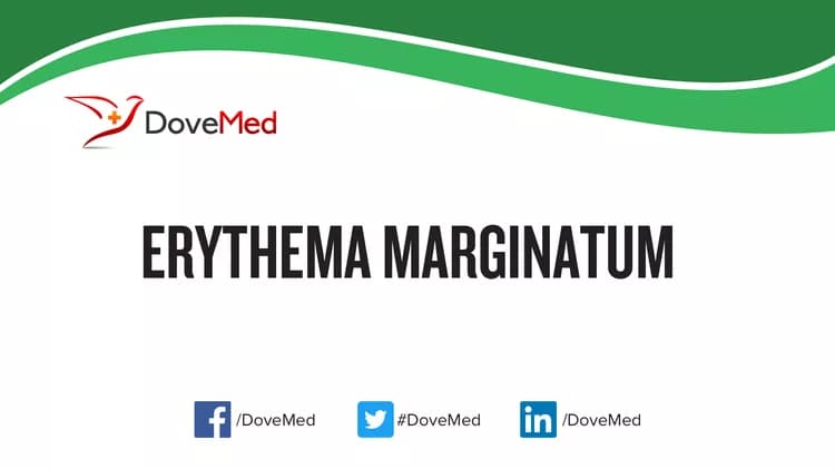 Can you access healthcare professionals in your community to manage Erythema Marginatum?