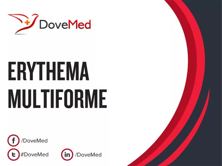 Is the cost to manage Erythema Multiforme in your community affordable?