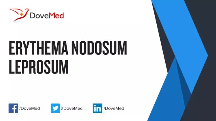 Are you satisfied with the quality of care to manage Erythema Nodosum in your community?
