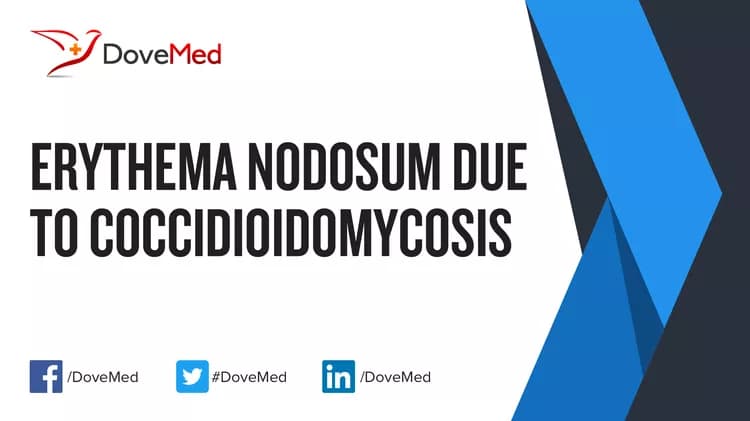 Can you access healthcare professionals in your community to manage Erythema Nodosum due to Coccidioidomycosis?