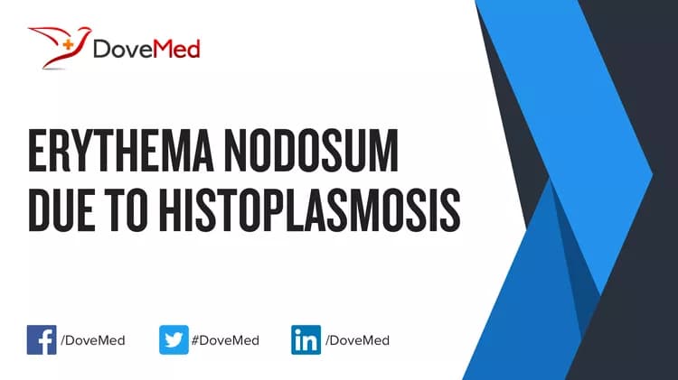Are you satisfied with the quality of care to manage Erythema Nodosum due to Histoplasmosis in your community?