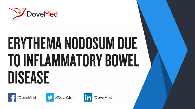 Can you access healthcare professionals in your community to manage Erythema Nodosum due to Inflammatory Bowel Disease?
