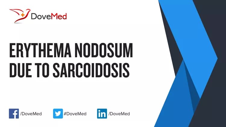 Can you access healthcare professionals in your community to manage Erythema Nodosum due to Sarcoidosis?