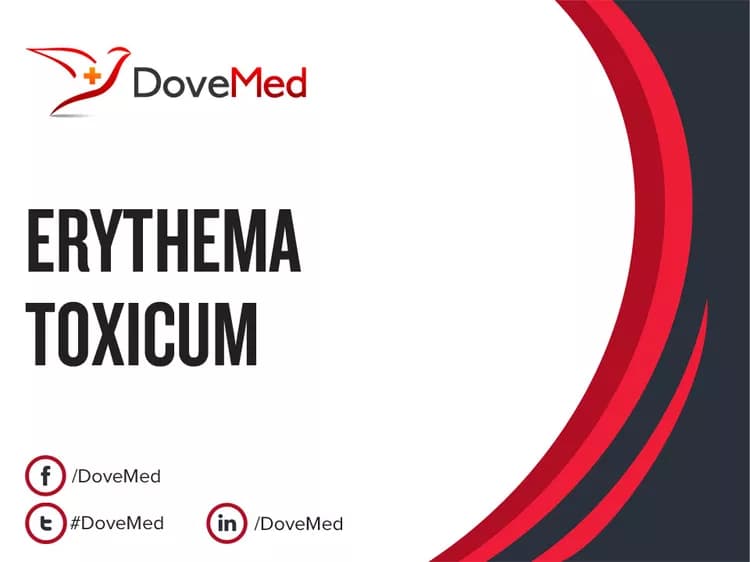 Erythema Toxicum