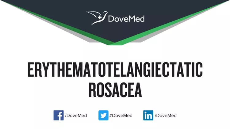 Can you access healthcare professionals in your community to manage Erythematotelangiectatic Rosacea?
