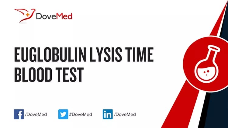 Euglobulin Lysis Time Blood Test