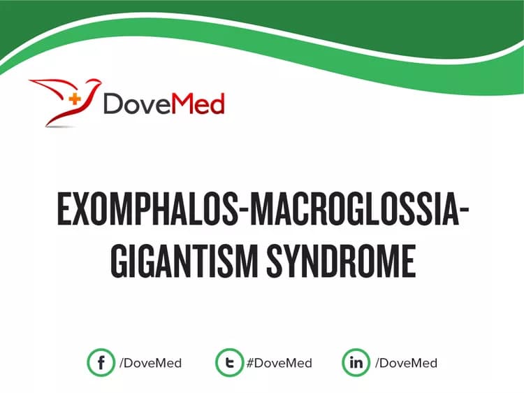 Exomphalos-Macroglossia-Gigantism Syndrome
