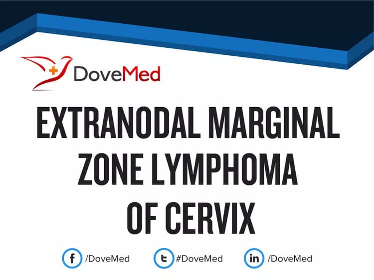 Extranodal Marginal Zone Lymphoma of Thymus Gland