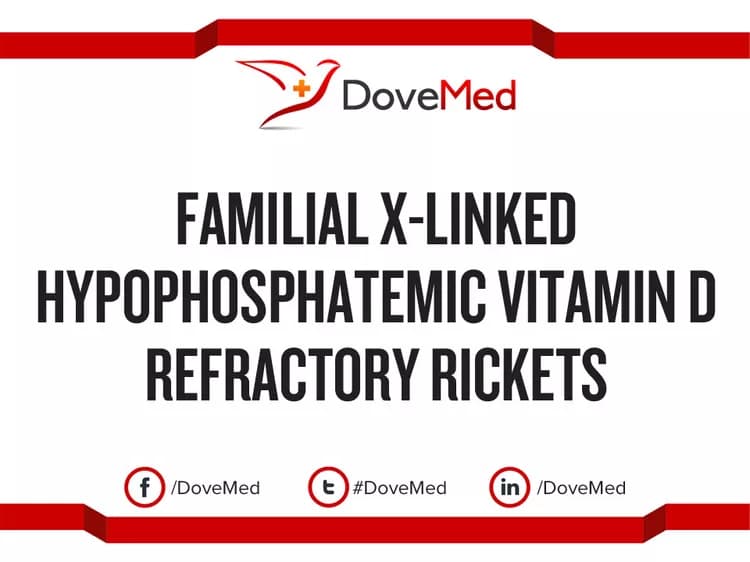 Familial X-Linked Hypophosphatemic Vitamin D Refractory Rickets (Disorder)