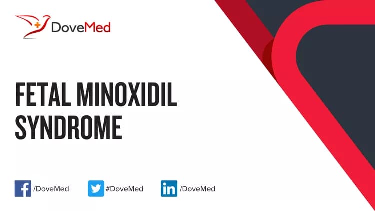 Can you access healthcare professionals in your community to manage Fetal Minoxidil Syndrome?