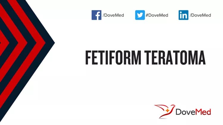 Can you access healthcare professionals in your community to manage Fetiform Teratoma?
