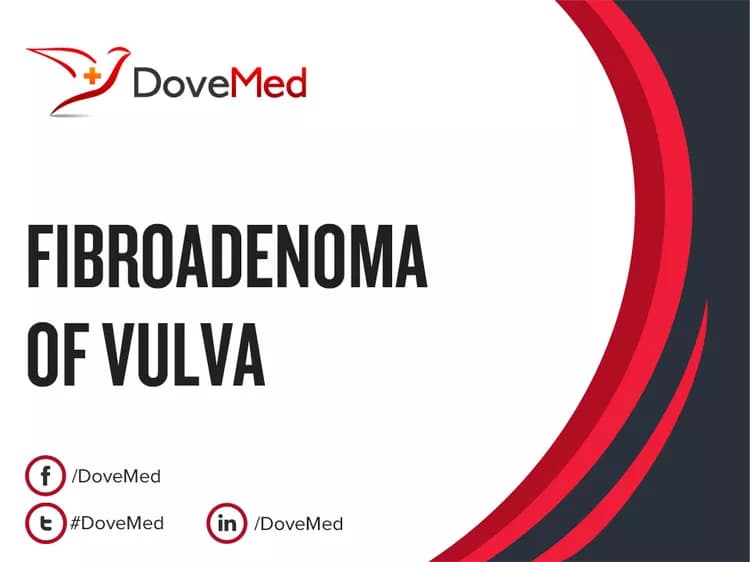 Can you access healthcare professionals in your community to manage Fibroadenoma of Vulva?