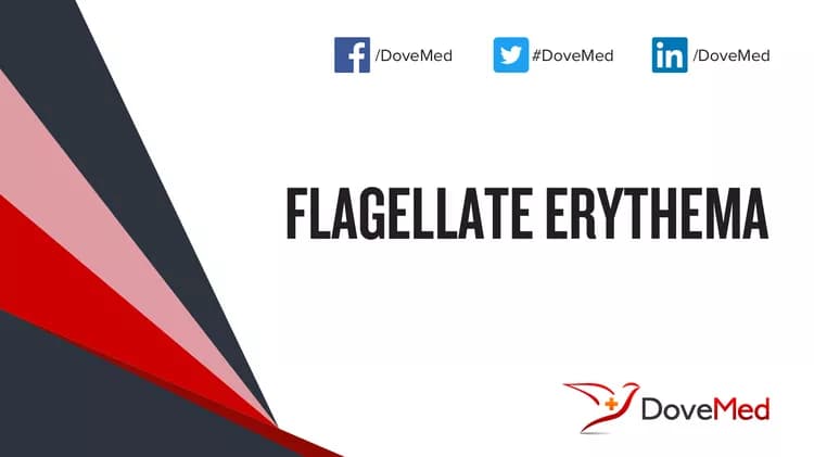 Are you satisfied with the quality of care to manage Flagellate Erythema in your community?