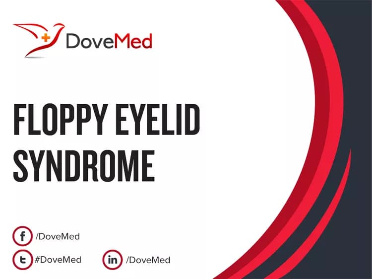 Can you access healthcare professionals in your community to manage Floppy Eyelid Syndrome?