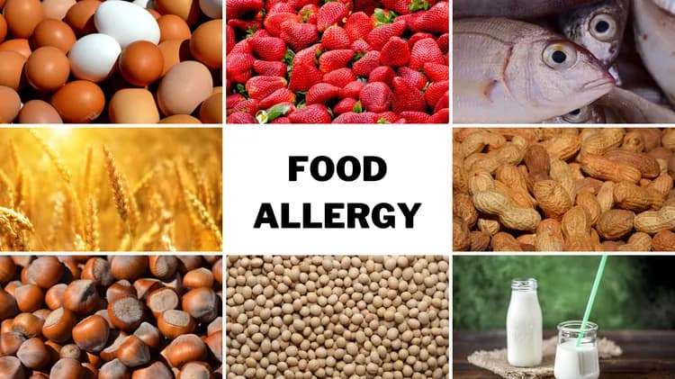 Are you satisfied with the quality of care to manage Food Allergy in your community?