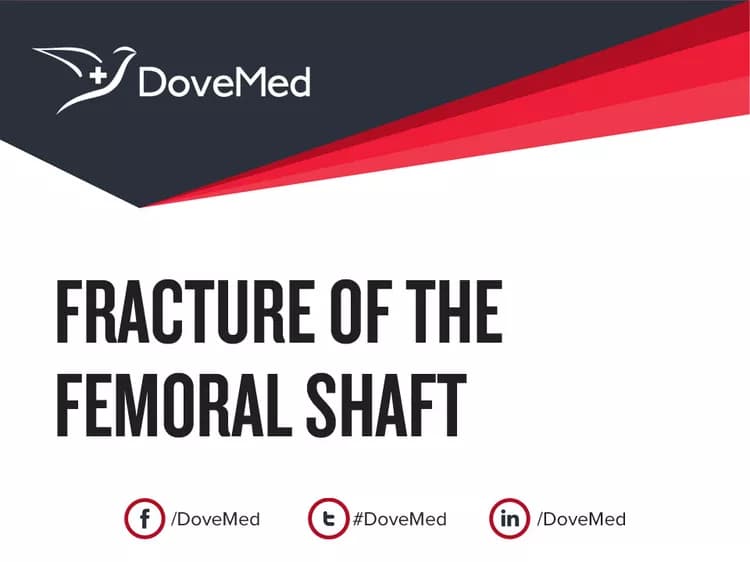 How well do you know Fracture of the Femoral Shaft?
