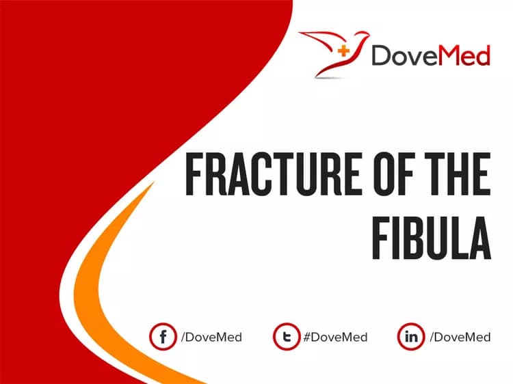 How well do you know Fracture of the Fibula?