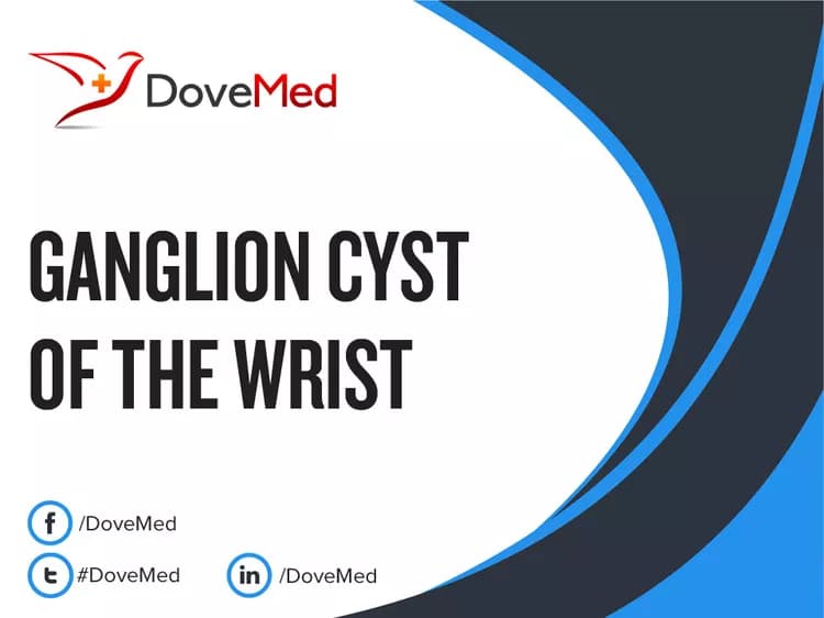 Is the cost to manage Ganglion Cyst of the Wrist in your community affordable?
