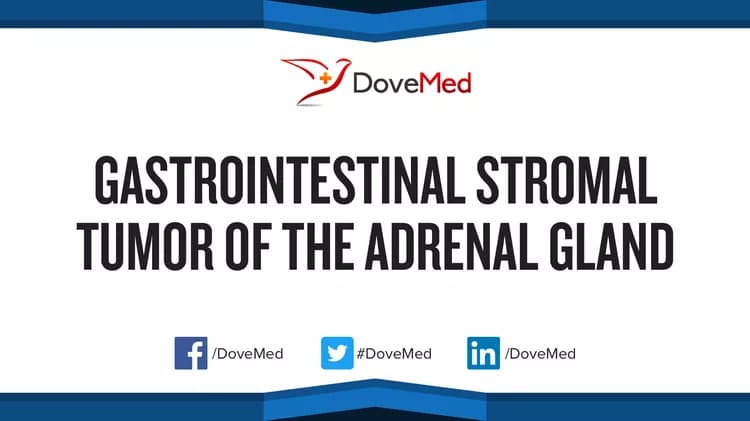 Can you access healthcare professionals in your community to manage Gastrointestinal Stromal Tumor of Appendix?