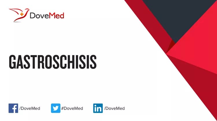 Can you access healthcare professionals in your community to manage Gastroschisis?