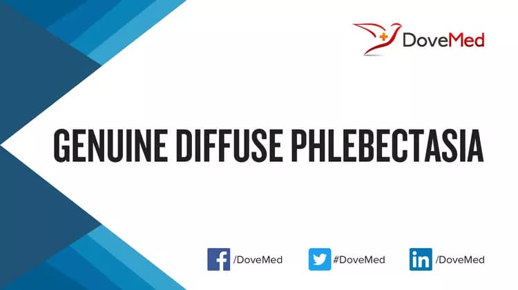 Is the cost to manage Genuine Diffuse Phlebectasia in your community affordable?