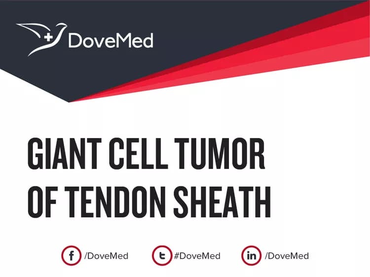 Can you access healthcare professionals in your community to manage Giant Cell Tumor of Tendon Sheath (GCTTS)?