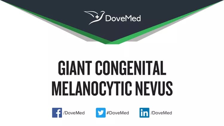 Giant Congenital Melanocytic Nevus