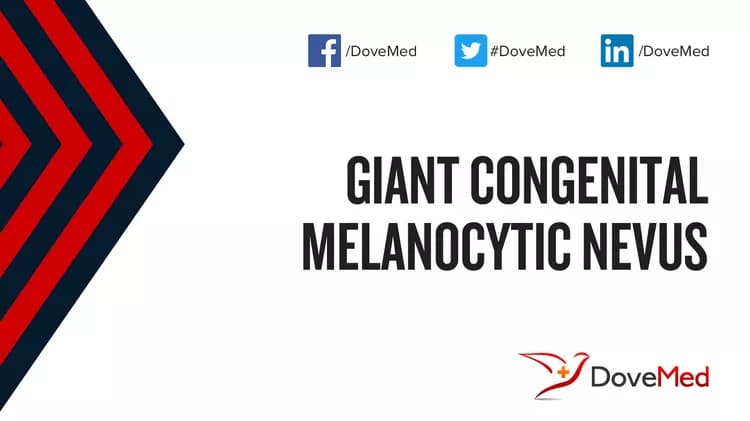 Can you access healthcare professionals in your community to manage Giant Congenital Melanocytic Nevus?