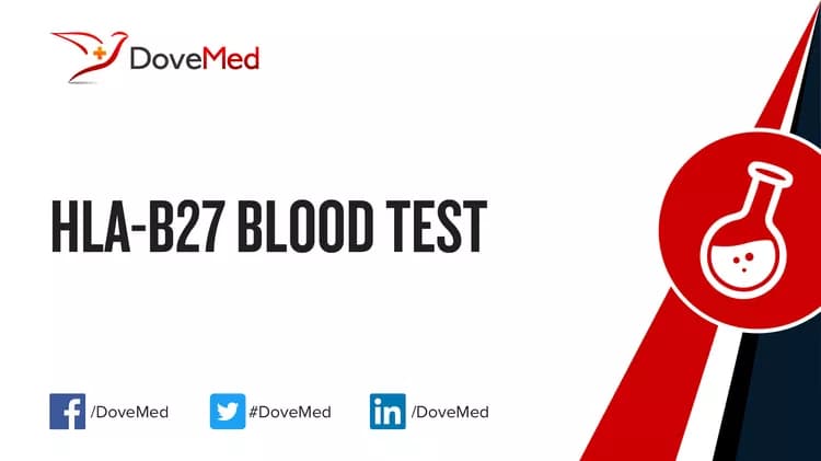HLA-B27 Blood Test