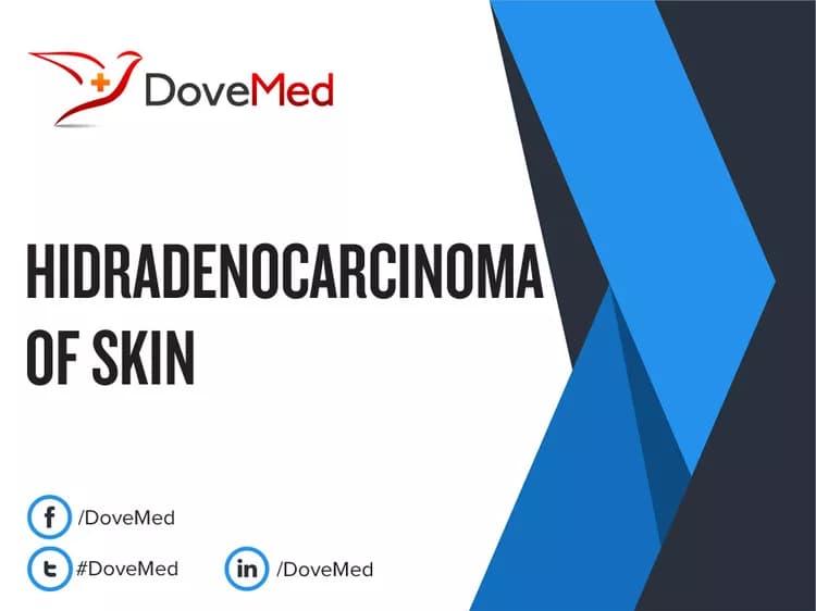 Can you access healthcare professionals in your community to manage Hidradenocarcinoma of Skin?