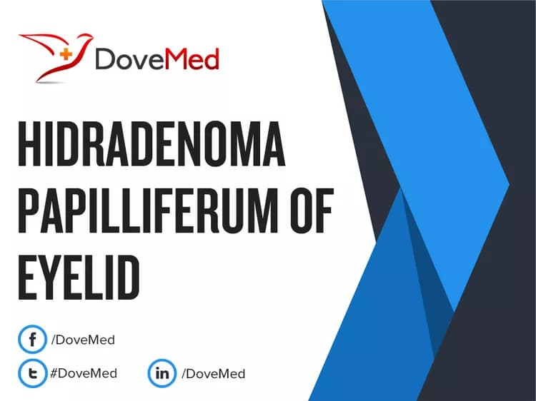 Can you access healthcare professionals in your community to manage Hidradenoma Papilliferum of Eyelid?