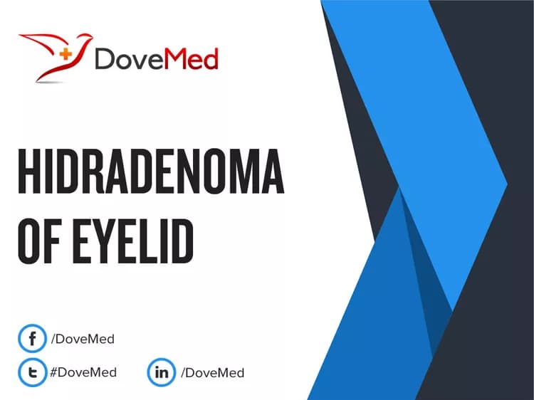 Can you access healthcare professionals in your community to manage Hidradenoma of Eyelid?