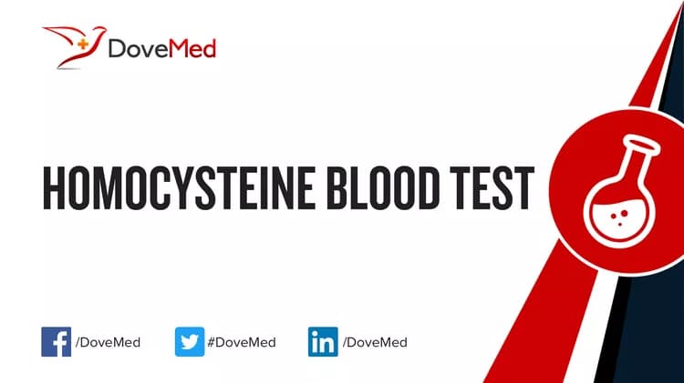 Homocysteine Blood Test