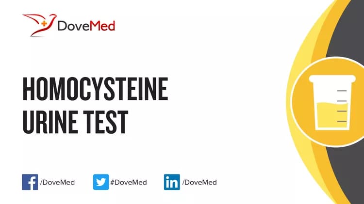 Homocysteine Urine Test