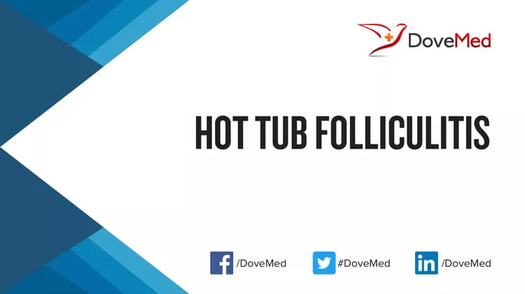 Is the cost to manage Hot Tub Folliculitis in your community affordable?