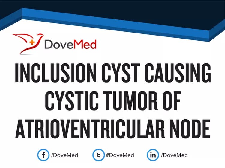 Inclusion Cyst causing Cystic Tumor of Atrioventricular Node
