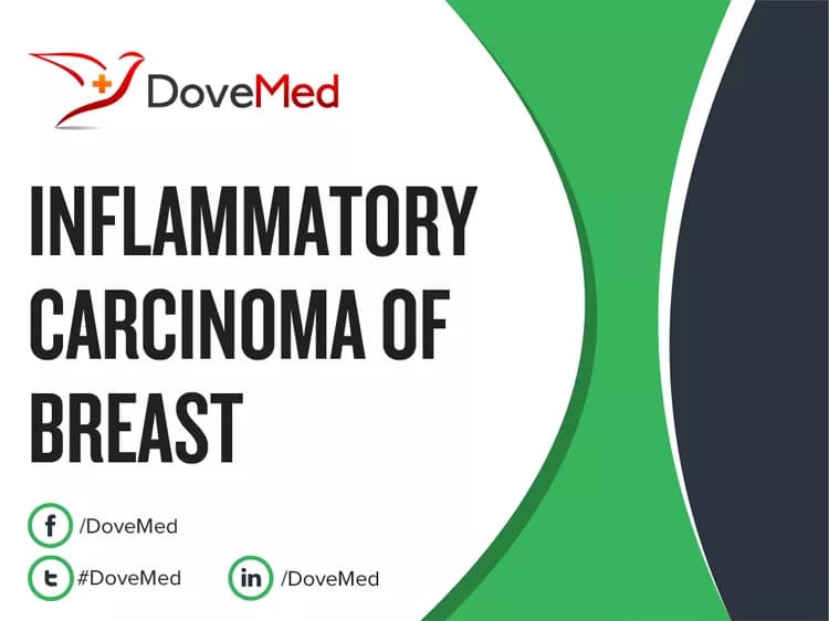 How well do you know Inflammatory Carcinoma of Breast?