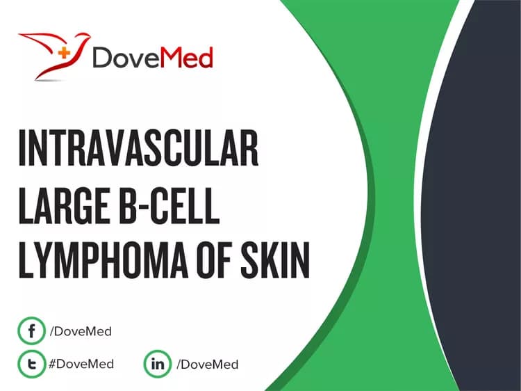 Intravascular Large B-Cell Lymphoma of Skin
