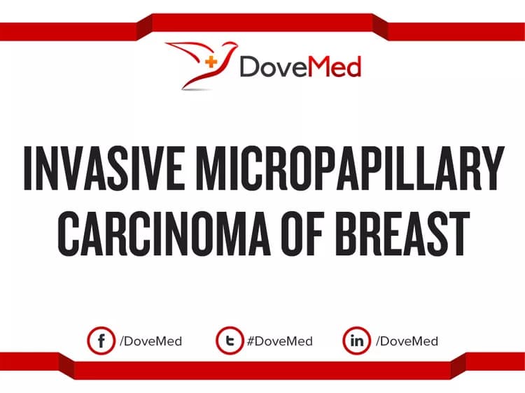 How well do you know Invasive Micropapillary Carcinoma of Breast?