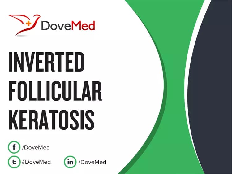 Can you access healthcare professionals in your community to manage Inverted Follicular Keratosis?