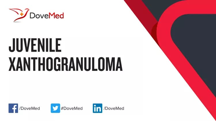 Can you access healthcare professionals in your community to manage Juvenile Xanthogranuloma?
